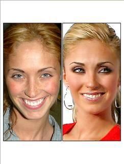 9 anahi nemachiata
